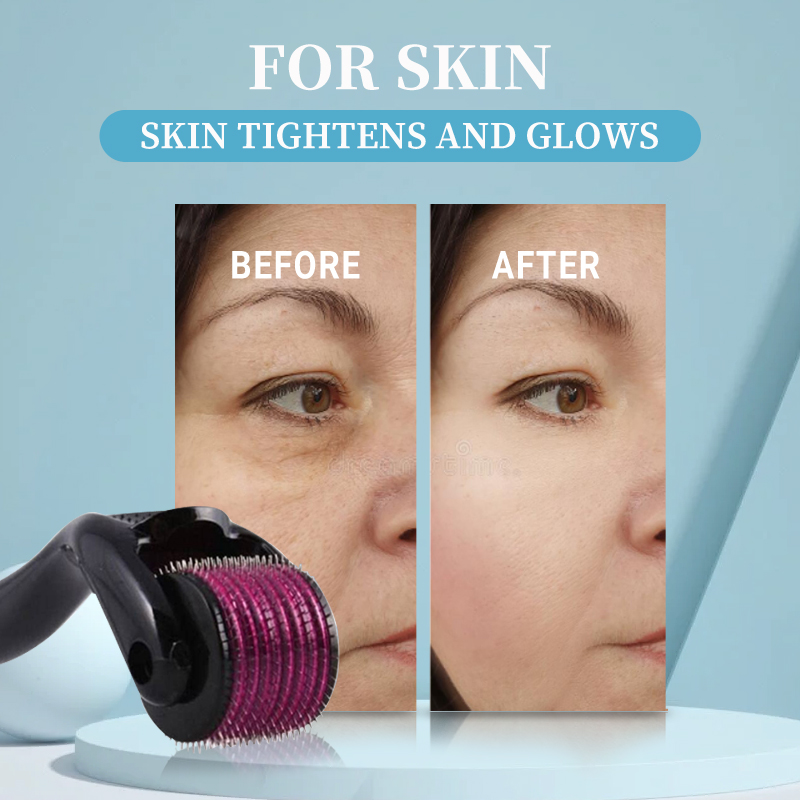 Professional 540 Roller Derma  - огляд і ціна Derma Roller 0.25